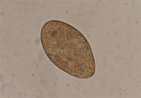 The very phrase connotes a certain grossness. Egg of parasite in stool stock image. Image of helminth - 95651861