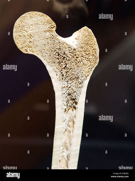 Human Bone Cross Section High Resolution Stock Photography And Images