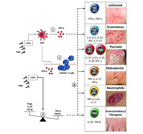 Classification And Pathogenesis Of Cutaneous Paradoxical Reactions To