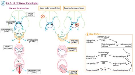 Oral Palatal Deviations And The Gag Reflex Ditki Medical And Biological