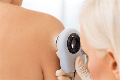 Annual Skin Checks The Dermatology Clinic