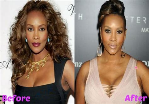 Vivica Fox Plastic Surgery Before And After