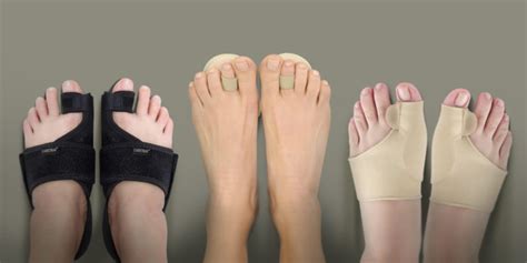 The Best Hammer Toe Splint Foot Health Hub
