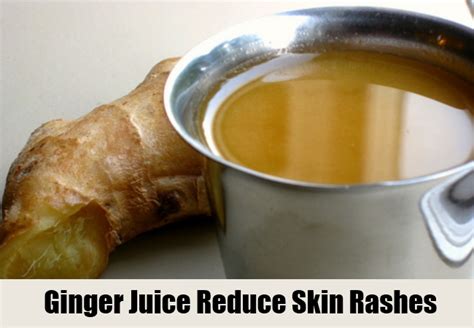 5 Home Remedies For Skin Rashes Natural Cure And Herbal Treatment For