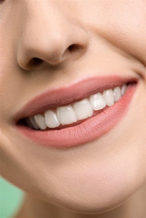 Dental Veneers For The Most Beautiful Smile Lifetime Dental Excellence