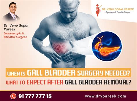 When Is Gallbladder Surgery Needed What Can I Expect Following