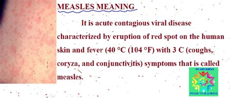 Measles Meaning Definition Causes Symptoms Diagnosis