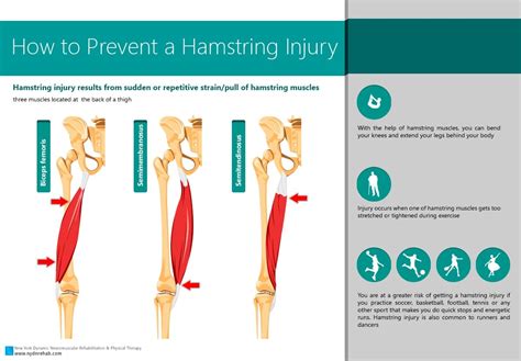 How To Prevent A Hamstring Injury