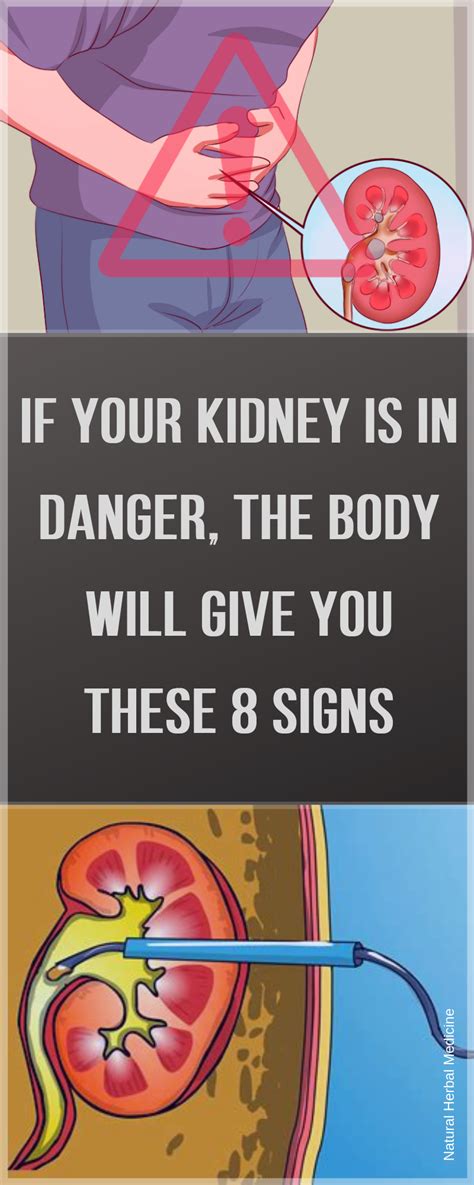 Each kidney is about 4 or 5 inches long, roughly the size of a large fist. Are The Kidneys Located Inside Of The Rib Cage : Anatomical diagram of a female figure with a ...