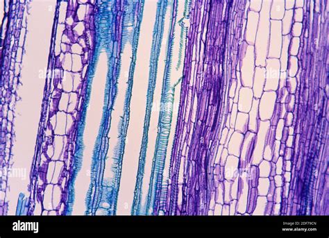 Phloem Purple And Xylem Blue On A Stem Longitudinal Section