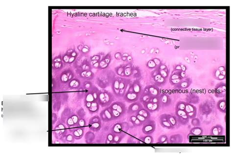 Lab Hyaline Cartilage Trachea Diagram Quizlet