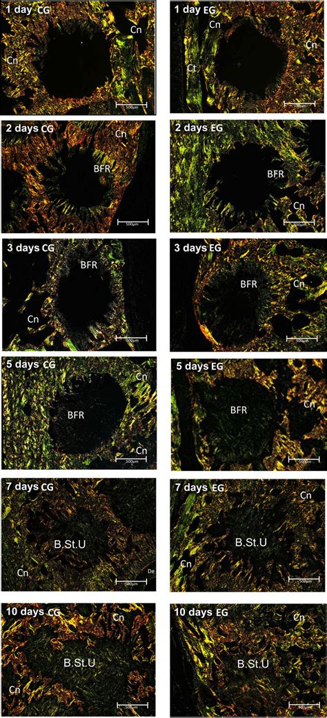 Polarized Light Photomicrographs From The Control And Experimental