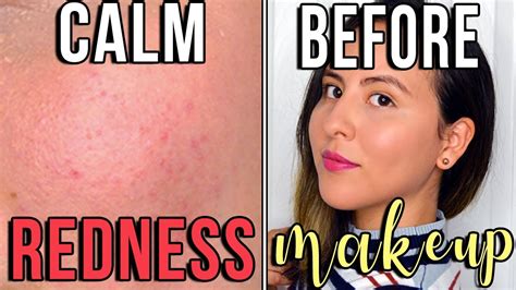 3 Easy Ways To Instantly Calm Red Sensitive Skin Affordable Student