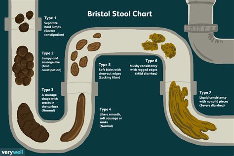 Bristol Stool Chart Checking If Your Poop Is Healthy