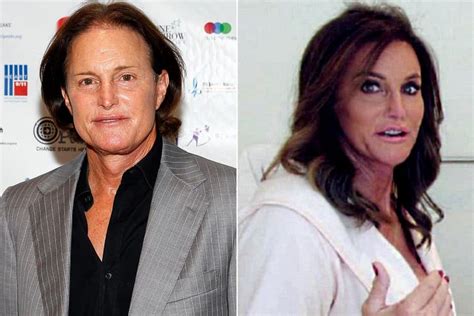Bruce Jenner Plastic Surgery Caitlin Before And After