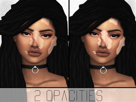 Vitiligo Overlay By Simplypixelated At Tsr Sims 4 Updates