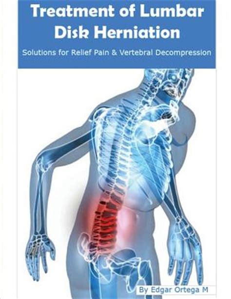 Treatment Of Lumbar Disk Herniation Back Pain Relief And Herniated