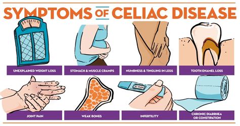 May Is Food Allergy Action And Celiac Disease Awareness Month Central