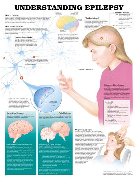 Understanding Epilepsy Anatomical Chart Physio Needs