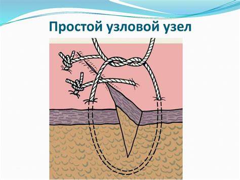 Простой узловой узел - online presentation Картинка - Простой узловой узел - online presentation