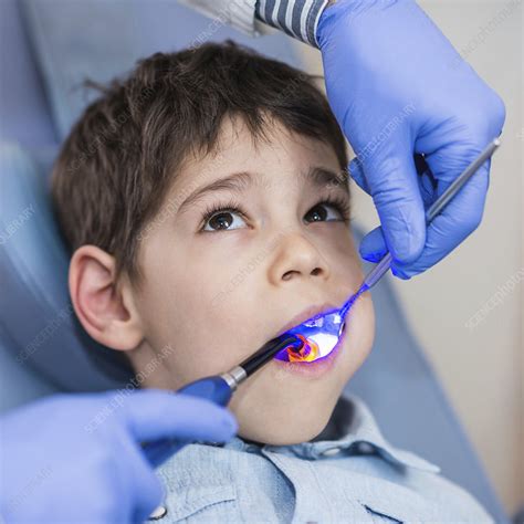 Dental Treatment Stock Image F0243497 Science Photo Library