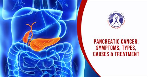 Pancreatic Cancer Symptoms Types Causes And Treatment