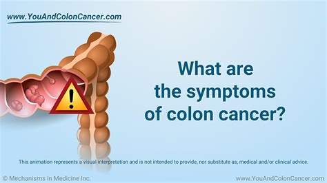 Slide Show What Are The Symptoms Of Colon Cancer