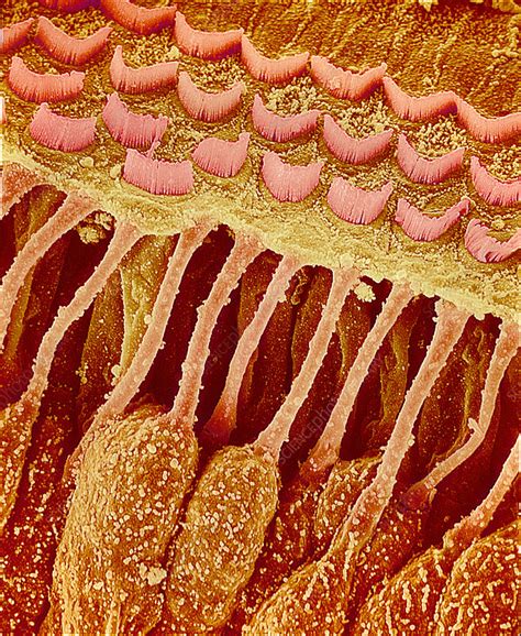 Sensory Hair Cells In Ear Coloured Scanning Electron Micrograph Sem