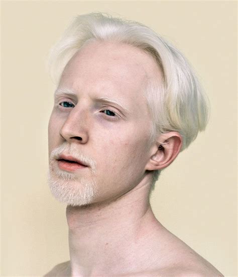 58 Albino People Who’ll Mesmerize You With Their Otherworldly Beauty Albino Men Albino Model