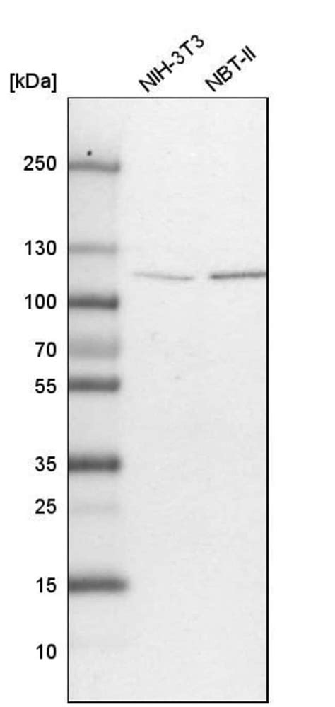 Ogt Polyclonal Antibody Invitrogen 100 μl Unconjugatedantibodies