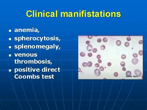 Hematologic Investigation Clinical Laboratory Diagnostics Of Anemias Anemia