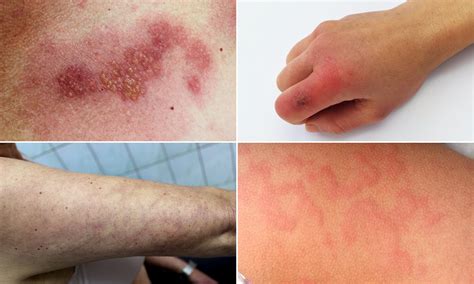 Tiny Red Blood Spots On Skin Itchy Weird Things That Happen To Your