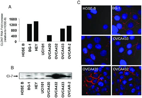 Cldn7 Expression In Ovarian Cancer Cell Lines A Claudin 7