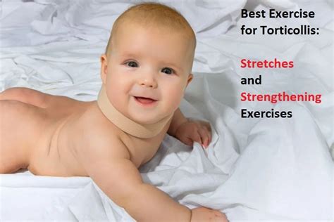 Physical Therapy For Torticollis Archives Samarpan Physiotherapy Clinic