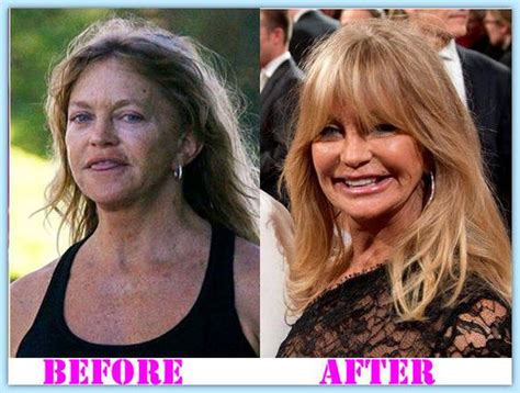 She rose to fame on the nbc sketch comedy program rowan & martin's. Goldie Hawn Plastic Surgery Before And After # ...