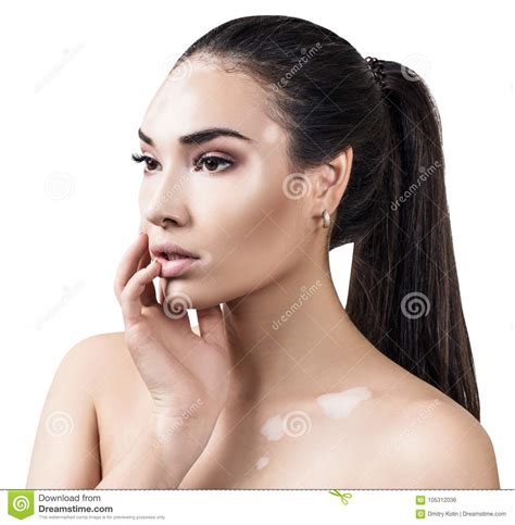 Portrait De Belle Femme Avec Le Vitiligo Photo Stock Image Du