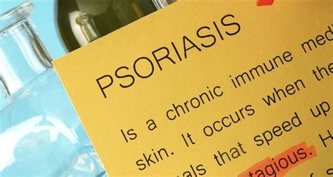 How To Treat Penile Psoriasis