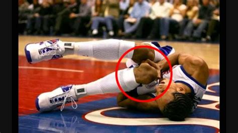 10 Most Gruesome Injuries In Nba History Youtube