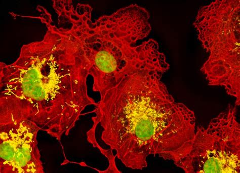 Transformed (Simian Virus 40) African Green Monkey Kidney Fibroblast