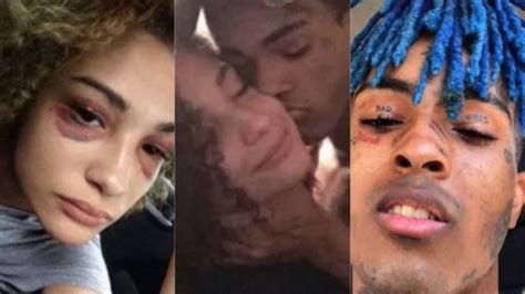 Xxxtentacion Admits To Stabbings And Beating Pregnant Girlfriend My