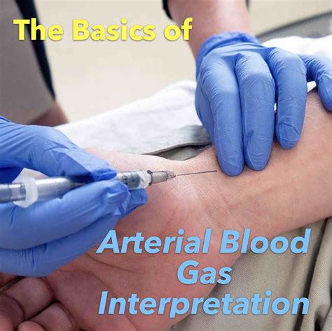 Arterial Blood Gas Interpretation Chart Arterial Blood Gas Icu SexiezPicz Web Porn