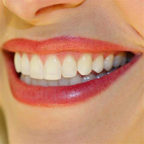 Bellevue Cosmetic Dentist Creates New Smiles Utilizing Many Modern