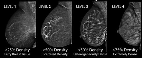 Common Breast Cancer Types And Ultrasound Images Interpretation New