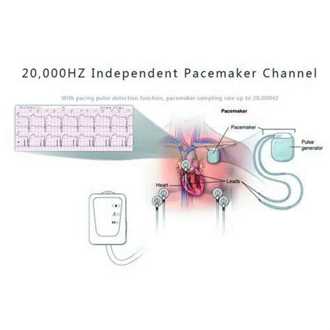 30 Holter Monitor 5 Lead Placement Diagram Wiring Database 2020