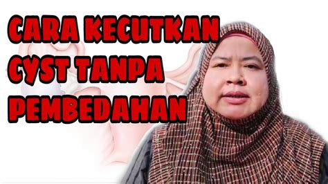 Cara tradisional menangkap ikan disawah подробнее. KECUTKAN CYST DENGAN CEPAT DAN BERKESAN - YouTube