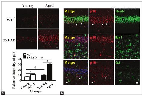 Amyloid β Protein Aggravates Neuronal Senescence And Cognitive Deficits