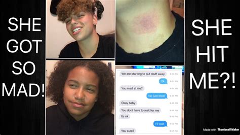 Hickey Prank On Girlfriend Gone Wrong Slapped Me Youtube