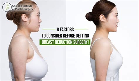 Factors To Consider Before Getting Breast Reduction Surgery