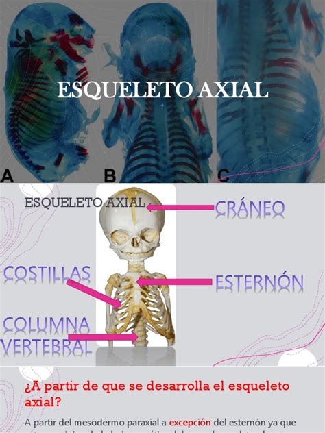 Esqueleto Axial Y Apendicular Pdf Cráneo Vértebra