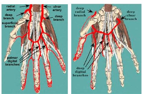 Arteries Of The Hand Right Hand Palmar View And Right Hand Dorsal